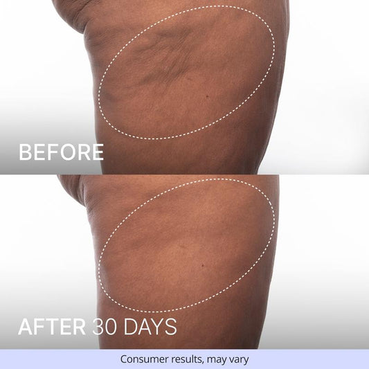 DermaOne™ Firming Butt and Thigh Cream