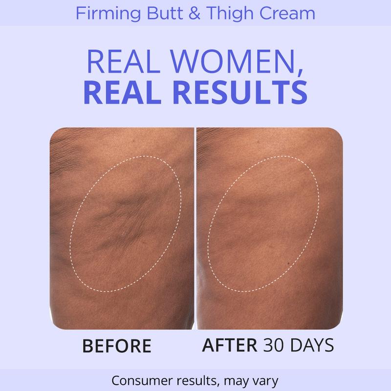 DermaOne™ Firming Butt and Thigh Cream
